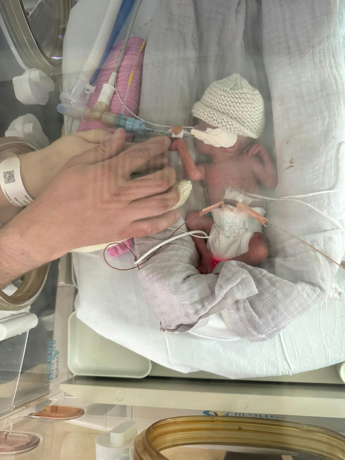 Baby Olive in the neonatal unit